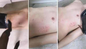 【兔粉粉女皇】爆踹 出血的踹