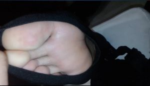 推到床上拉伸脚趾