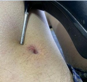 【蓝色-凌然】超细打磨的鞋跟大腿钻血洞，10和12厘米高跟跺肚子-97LZTD-83505156